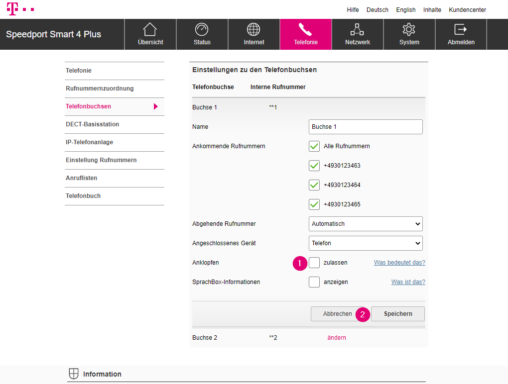 Speedport Smart 4 Plus Anklopfen deaktivieren