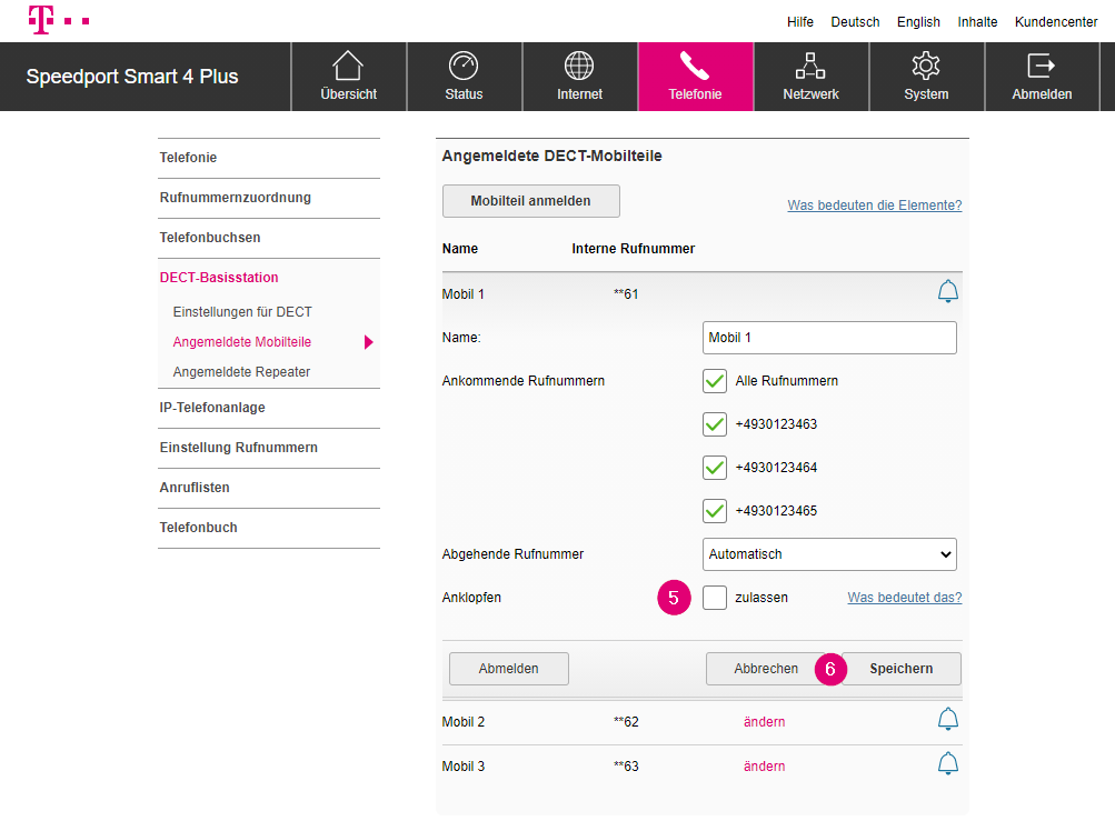 Speedport Smart 4 Plus DECT Anklopfen deaktivieren